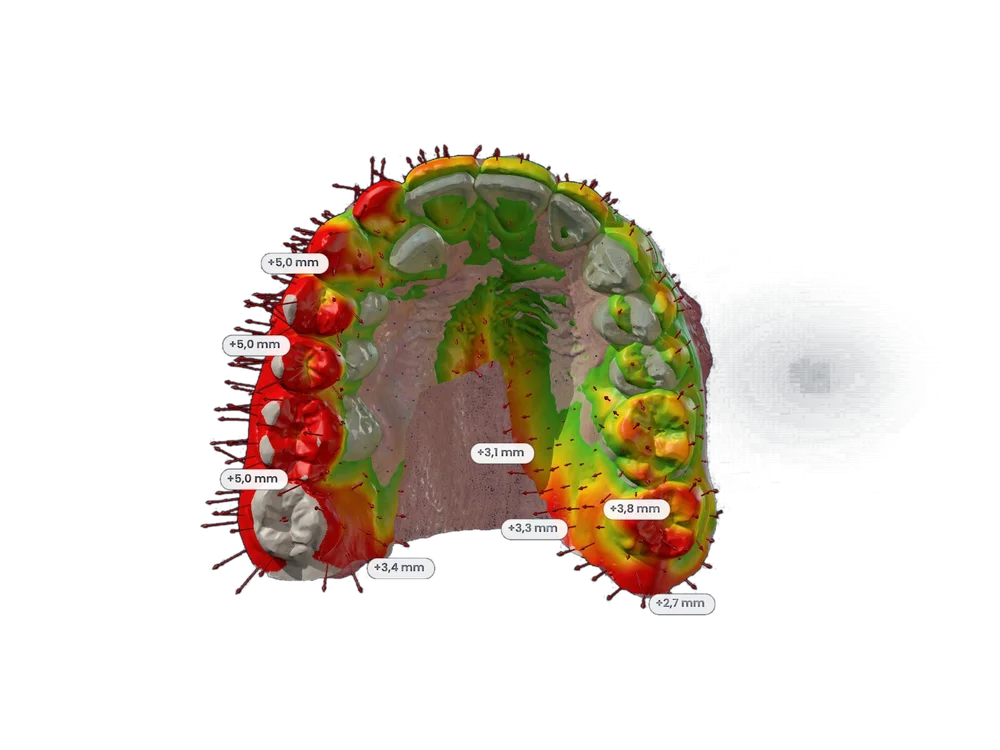 Mapa de superposición de dos modelos en color